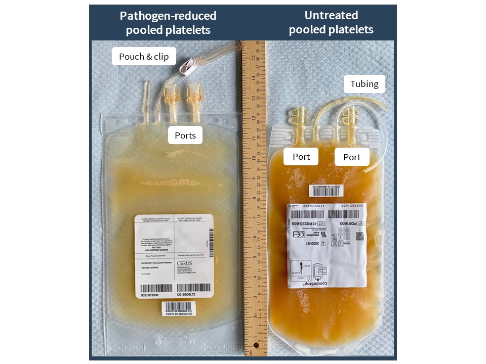 Pathogen-reduced buffy coat platelets, Figure 2.