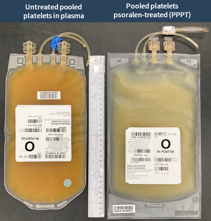 Comparison of two platelet bags side-by-side (EN) 