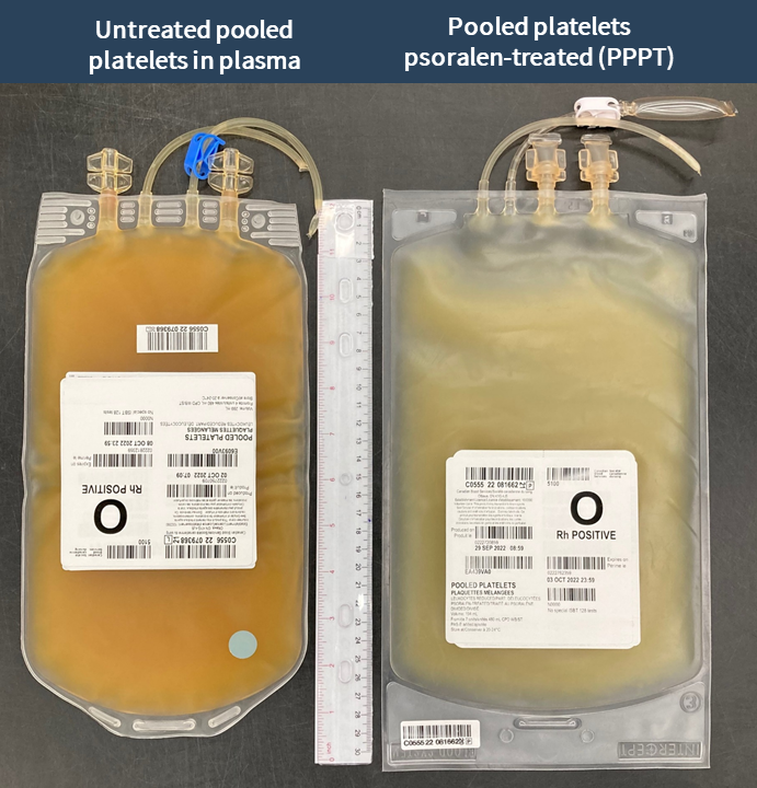 Two platelet units side-by-side. 