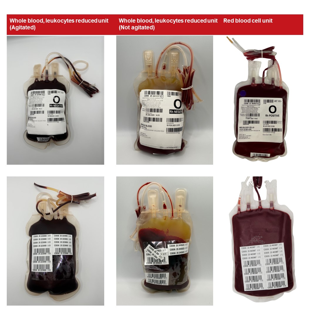 A 3-column by 2-row grid of LrWB and red blood cell units compared visually. The first column is "whole blood, leukocytes reduced unit (Agitated)". The second column is "whole blood, leukocytes reduced unit (Not agitated)" and the third column is "red blood cell unit".