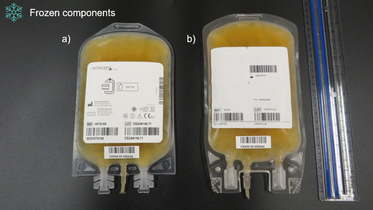 Two bags side by side. One contains apheresis frozen plasma, psoralen-treated and the other contains apheresis plasma. They are yellow. 