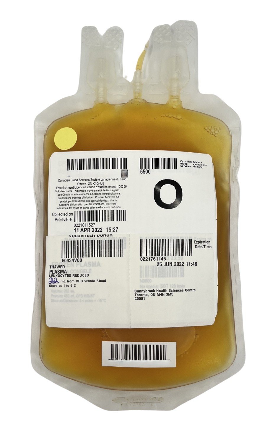 An example of a typical unit of plasma manufactured from whole blood. 