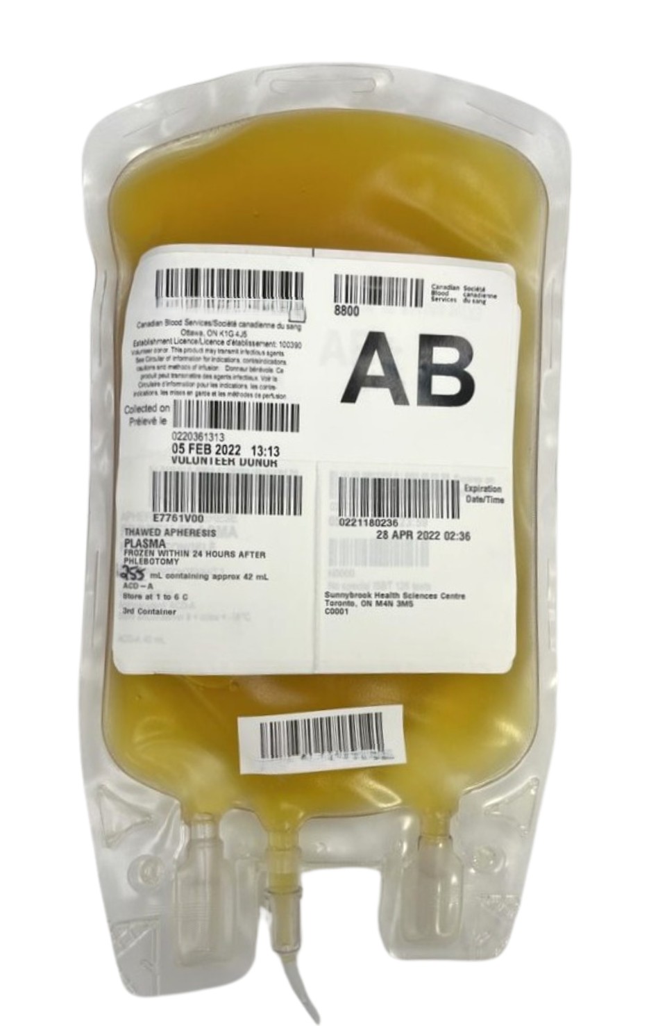 An example of a typical unit of plasma manufactured using apheresis method. 