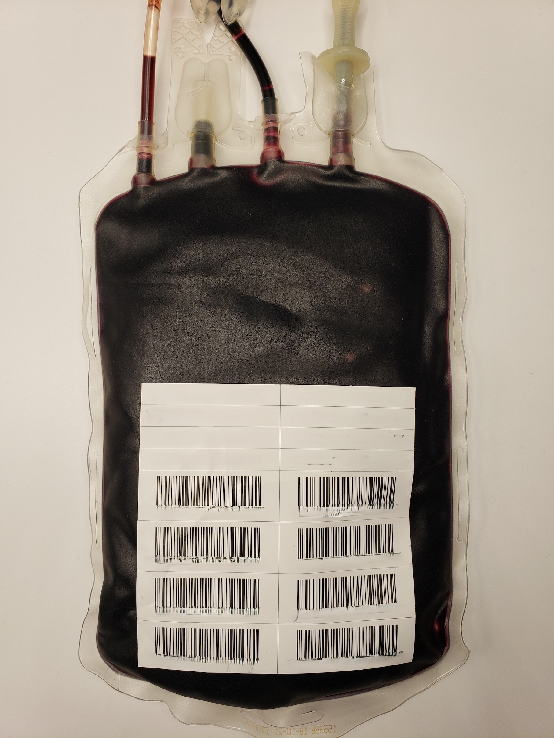 Serratia liquefaciens contamination, Day 25 