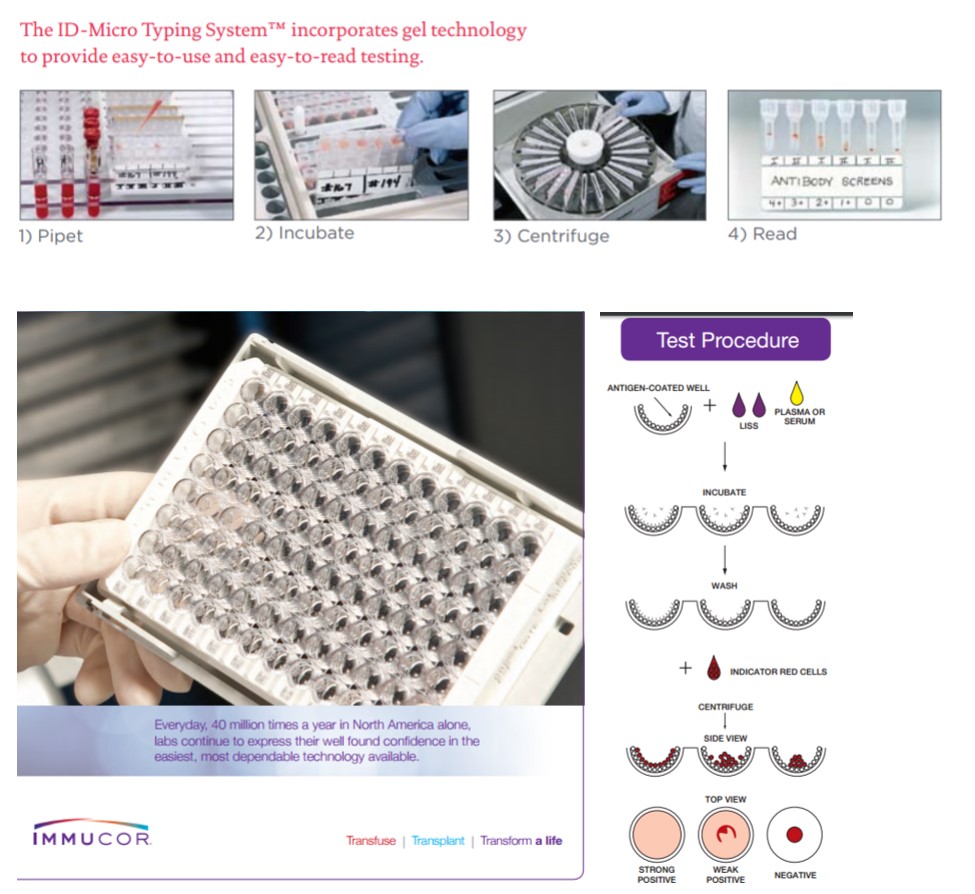 File:Blood typing by gel card method (column agglutination or MTS