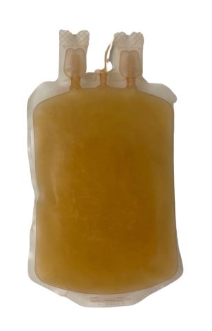 A unit of plasma viewed from the back and pictured frozen. 