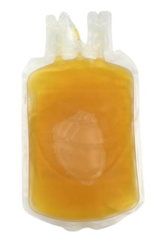 A unit of plasma viewed from the back.