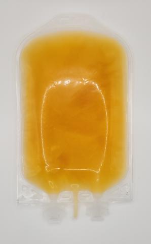 An example of a typical unit of apheresis frozen plasma, psoralen-treated from Canadian Blood Services. This image shows the back of the frozen unit 