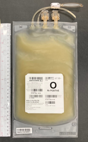 A unit of pooled platelet components approximately 31 cm in height and 18 cm wide.