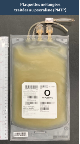 Unité de plaquettes mélangées traitées au psoralène. Les poches de PMTP mesurent 31 x 18 cm et disposent de deux orifices de sortie pour la transfusion ainsi qu’un système d’échantillonnage intégré.