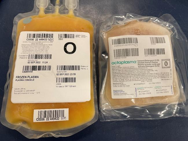 Two bags of frozen plasma pictured side by side. 