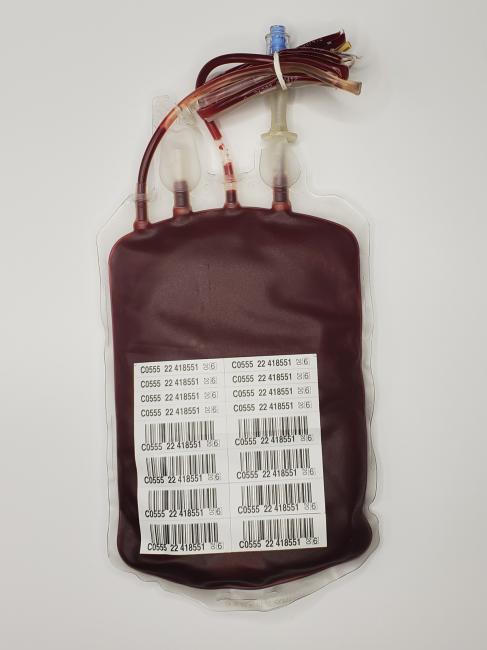 Red blood cells: Bacterial contamination | Professional Education