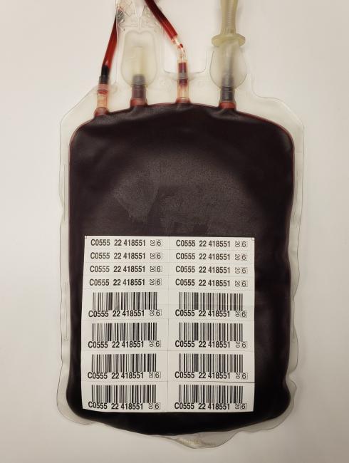 Red blood cells: Bacterial contamination | Professional Education
