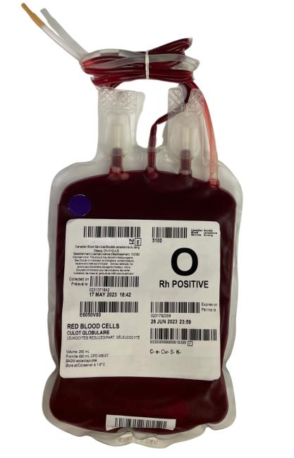 An example of a typical RBC unit.